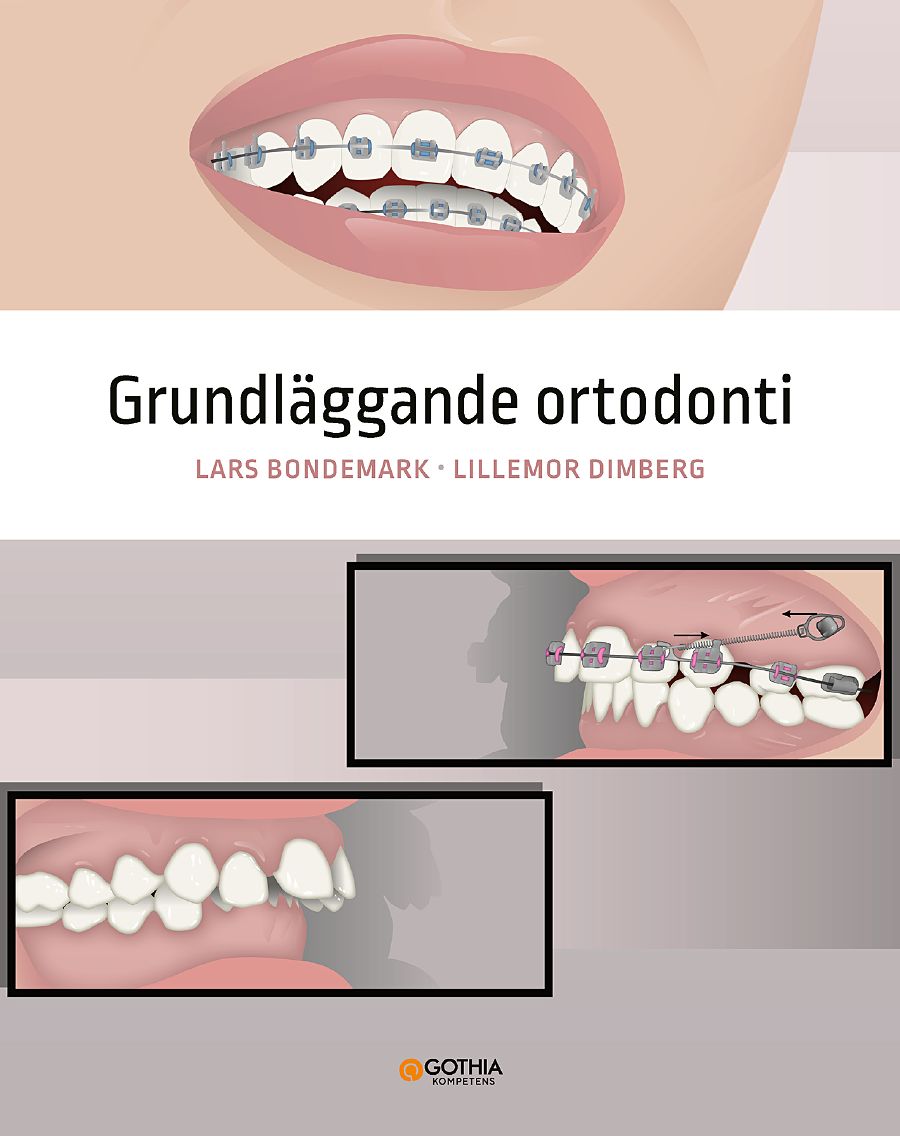 Omslag: Grundläggande ortodonti